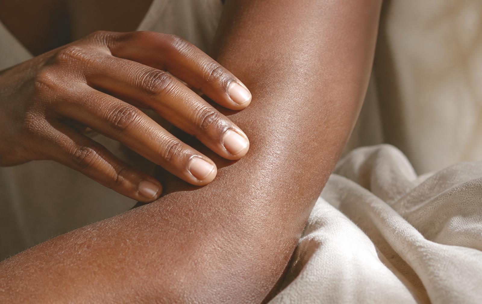 Peau atopique : comprendre pour mieux apaiser